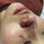 +추가+추가) 개에게 물린 후 <b>sns</b>에서 마녀사냥을 당했습니다....