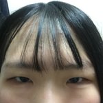 [드루와] 쌍수+앞뒷밑틤 하몀 잘 될까?   ㅠㅠ