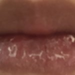 [ㅋㅋㅋㅋㅋ] 약혐) 입술각질 나보다 심한사람 있냐