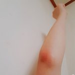 나 팔꿈치 엄청 <b>핑크</b><b>색</b>임ㅋㅋㅋㅋ