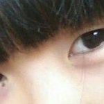 쌍수 후기