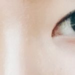 <b>무쌍</b> 쌍수