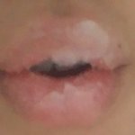 [사진좀혐오] 입술에 바세린 이정도 바르면 각질 제거 가능?