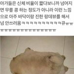애들아 필러 절대 하지마...
