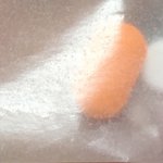 [다이어트] 식욕억제제 먹고 붉은 <b>반점</b> 나타남 ㅠ