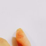 나 손에 화상 입은 거야?