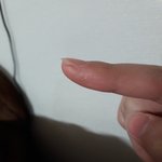 나 이거 건조해서 이러는거야?