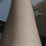 약혐) 얘두라 내 다리털하고 <b>팔</b><b>털</b> 볼래? ><
