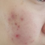 <b>미세</b>먼지로 뒤집어진 피부 복구한 후기 :)