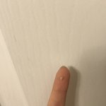 [드루와] <b>내</b> <b>입</b>냄새 드디어뺐다 ,,,, 사진있음 극혐주의 +추가했어요