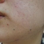 요즘 파데 뜨는 사람, 민감성피부인사람 필독!!!!!