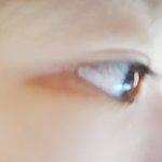 [ㅅㅂ] 나 같은 애 있냐? 눈 뒤가 <b>착색</b>됨