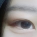 [댓글부탁해] 나 눈두<b>덩이</b>에 살많은편이야?