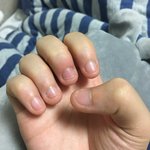 나보다 <b>손톱</b>상태 심한사람..
