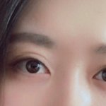 [방탈죄송] <b>미간</b>보톡스후 부작용