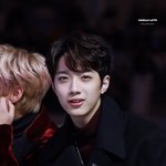 쌍수 해본애<b>등아</b> ㅠㅠ붓기