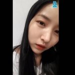 소원 쌍수하고 얼굴<b>변형</b>됨