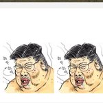 [19] 유두에 털이 났어요....