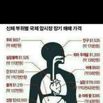 [댓글부탁해] 너네 이런상황에 어떻게 할거임?