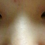 [댓글부탁해] 얘들아 나 <b>복코</b>임??