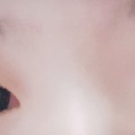 [댓글부탁해] 쌍수 하는게 더 나을까?