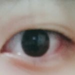 [댓글부탁해] <b>한쪽</b> 눈 쌍커풀 없어짐;