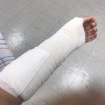 [긴급](+수정) 억울하고 부당한 화상입은 알바생의 최후!!!!...