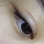 [댓글부탁해] 쌍수 <b>재수술</b> 각인가