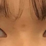 나 <b>짝눈</b> ㅈㄴ 심해