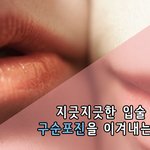 <b>입술</b>의 침략자 구순포진!!