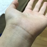 이거 <b>핏줄</b> 파랑색이냐 초록색이냐