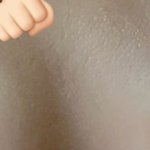 [드루와] <b>미</b>간 좁쌀 여드름 다 없앴어!! 사진ㅇ