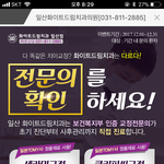 [댓글부탁해] <b>일산</b>치과 여기 아는사람??