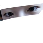 나 나중에 쌍수할까