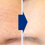 애 낳고 나서 기미도 엄청 생기고 주름도 많이 늘었는데