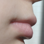 [꼭조언부탁] 입술 어떻게 해야 할까요ㅠㅠㅠ
