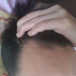 [꼭봐주세요] <b>이마</b>넓이 평가 부탁해여