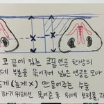 이거 <b>코</b><b>끝</b>연골수술 설명인데