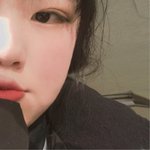 [댓글부탁해] <b>쌍수</b> 한달 째인데 <b>라인</b>이 이상함