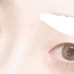 [댓글부탁해] 나 쌍수 많이 망했는데 <b>재수술</b>ㅠ