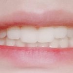 [댓글부탁해] 얘들아 나 <b>치열</b>고른편임?
