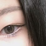 눈수술 뭐할지 조언좀ㅠ