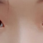 <b>눈성형</b>머머해야돼