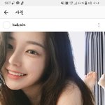 손화민 이빨 봤어? 라미네이트 한건가?