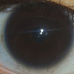 <b>내</b><b>눈</b>좀봐줘ㅠㅠㅠㅠ이거병이야?