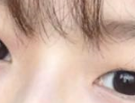쌍수 추반좀 ㅠㅠ
