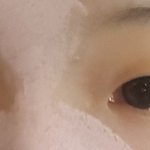 쌍수+<b>눈매</b>교정하기로했는데 앞트임,윗트임도하면 더예뻐질거같음?