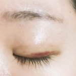 얘들아 나 매몰했는데 아직두 <b>피멍</b>이안빠져 원래이래?