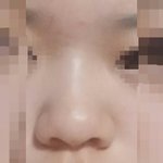 [조언부탁해] <b>코필러</b> 해본 사람