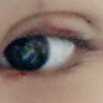 [드루와] 쌍수7일후기